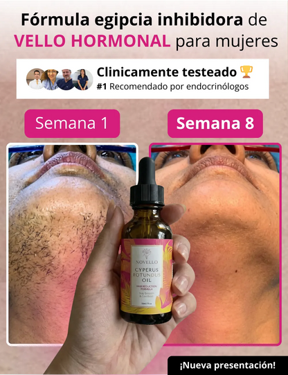 Cyperus oil
